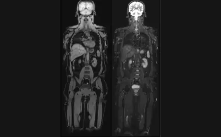 Aarthi Scans and Labs Launches ‘Vital MRI’: A New Chapter in Preventive Healthcare with Full Body MRI Scans