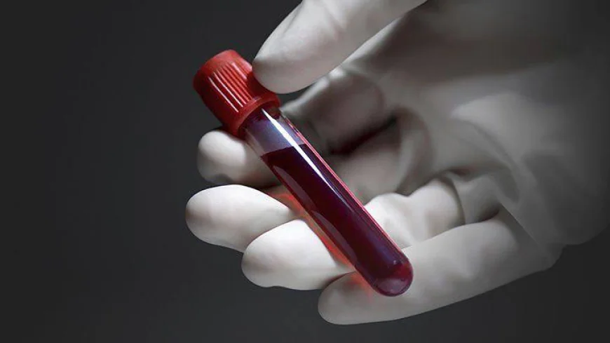 How to Check for Blood Infections?