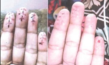 Fingerprint surgery gang exposed in Telangana