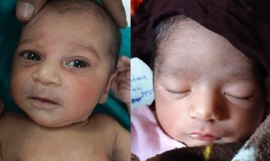 Child exchange in Jaipur, police will get DNA test done