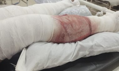 Killer attack on youth in Jaipur broke hands and feet