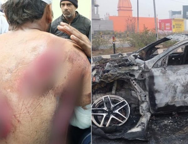 Rishabh Pant was badly injured when his car hit a divider and caught fire