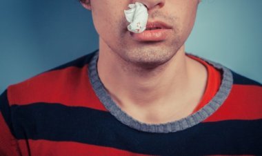 Nose bleed, fever and then death: 8 died due to unknown disease in this country of Africa, 200 quarantined