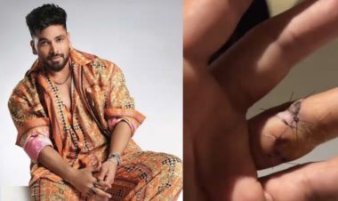 Shiv Thakare got hurt during stunt performance, many stitches in his fingers, fans gave this reaction