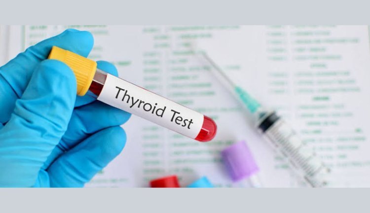 Thyroid Blood Test: Types, Normal Levels, and Analysing Results