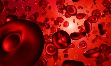 Blood Cancer: Bariatric surgery reduces the risk of blood cancer, research reveals