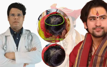 OMG! Is Bageshwar Baba Dhirendra Shastri Going Bald? Doctor Ashok Sinha Reveals All!