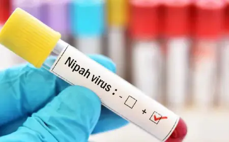 Nipah virus confirmed in bat samples in Kerala, 14-year-old teenager died due to infection
