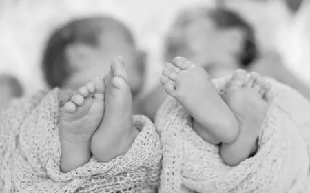 Twins born in Rajasthan are suffering from a rare disease where their skin is like plastic