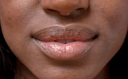 Some winter care tips for soft lips for your dry and flaky due to cold winds