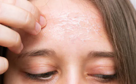 Use these healthy tips to get rid of dryness on forehead