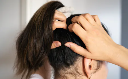 Some home remedies to get relief from dandruff