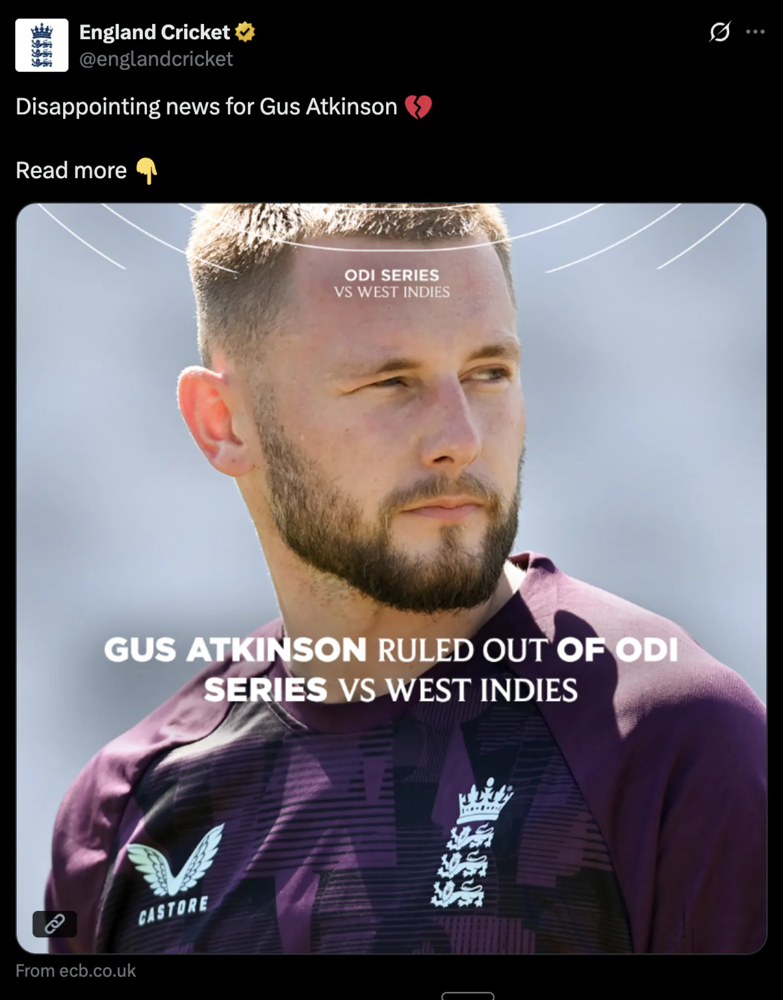 England cricket team got a big blow, this fast bowler is out of the series