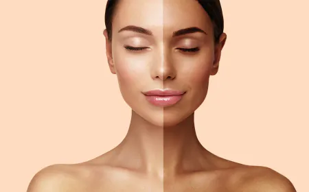 Remove Stubborn Tanning in 7 Days with This Simple Raw Milk Remedy