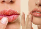 Natural Lip Care Tips to Keep Your Lips Soft and Hydrated This Winter
