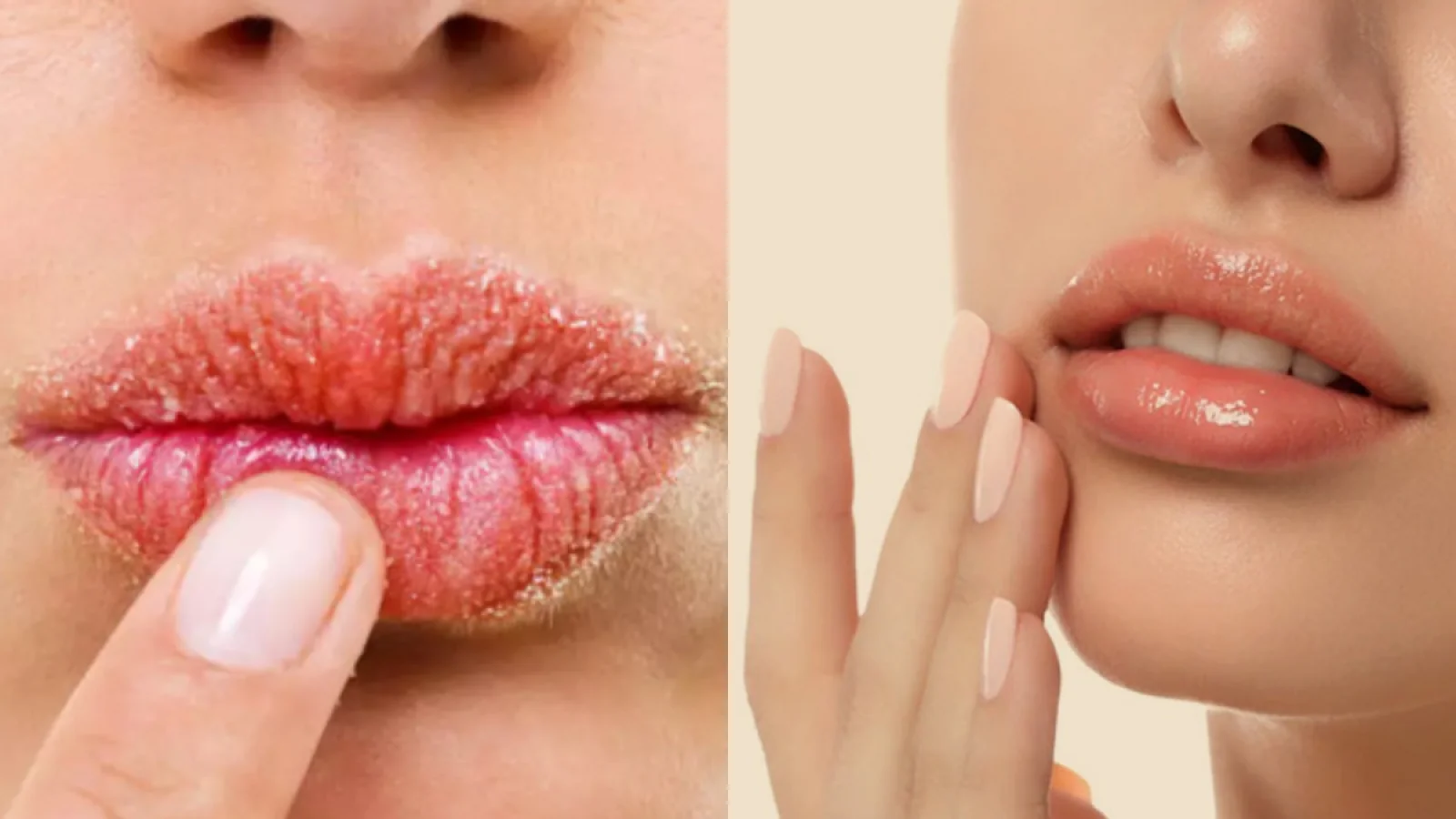 Natural Lip Care Tips to Keep Your Lips Soft and Hydrated This Winter