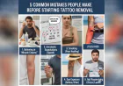 5 Common Mistakes People Make Before Starting Tattoo Removal