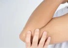 Natural Ways to Lighten Hyperpigmentation on Elbows and Knees