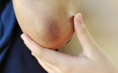 Dark Elbows and Knees? Try These Simple Kitchen Remedies to Reduce Hyperpigmentation Naturally