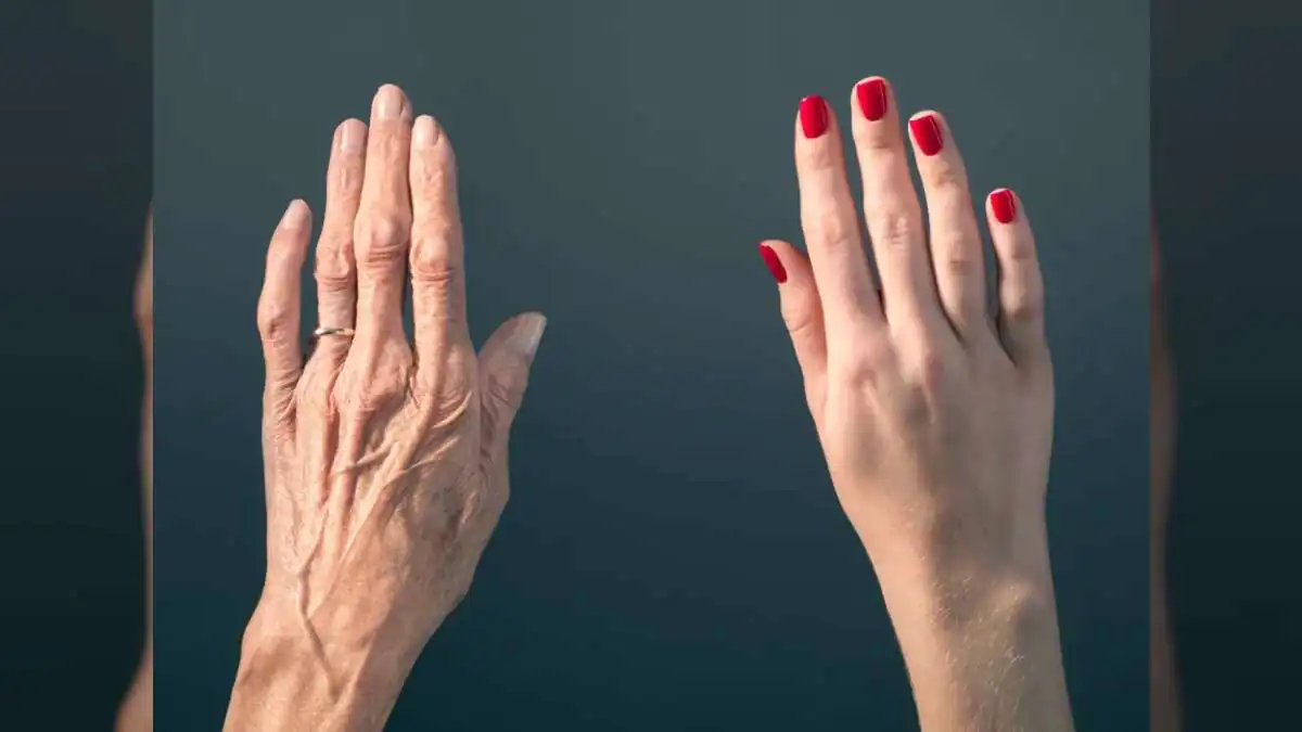 Beauty Trends Shift: ‘Hand Shaming’ Sparks Billion-Rupee Skincare Market