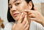 Acne-Free Skin Starts Here: Expert-Backed Hygiene Tips You Must Follow