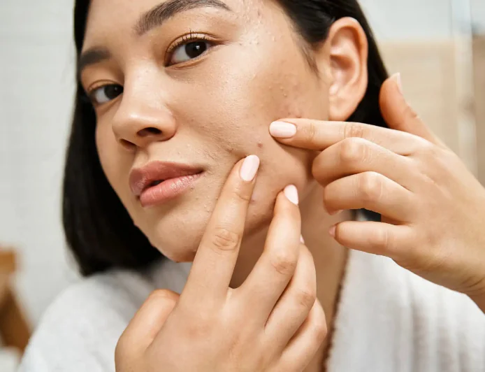 Acne-Free Skin Starts Here: Expert-Backed Hygiene Tips You Must Follow