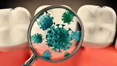 Scientists develop breakthrough gum disease treatment that targets harmful bacteria without killing good microbes